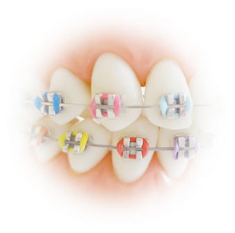 マルチブラケット装置とカラーゴム